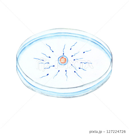 不妊治療 妊活 体外受精 ふりかけ法 水彩 イラスト 不妊治療 妊活 体外受精 ふりかけ法 水彩 イラスト 127224726