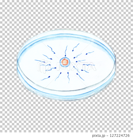 Infertility treatment, pregnancy, in vitro fertilization, furikake method, watercolor illustration 127224726