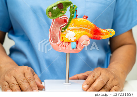 Pancreatitis, pancreatic cancer, Asian doctor with pancreas, gallbladder and bile duct human anatomy model at hospital. 127231657