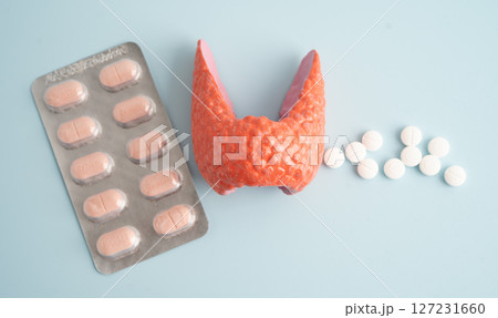 Thyroid model with pill drug treatment, Hyperthyroidism, Overactive or Lymphoma. 127231660