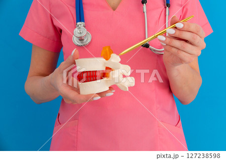 Anatomical lumbar disc herniation model in doctor hand while consultation in medical clinic. Intervertebral hernia treatment 127238598