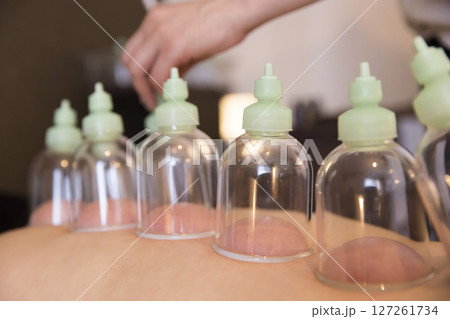 カッピングイメージ カッピングイメージ 127261734