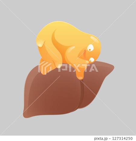 Cartoon concept for fatty liver disease or hepatic steatosis disease 127314250