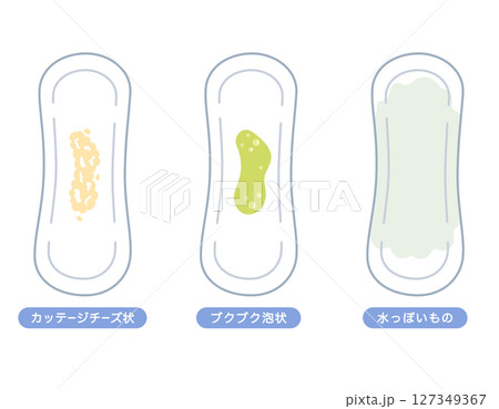 女性の健康　おりものの色の種類　ナプキン 127349367