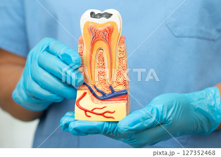 Asian dentist holding dental implant, artificial tooth roots into jaw, root canal of dental treatment, gum disease, teeth model for dentist. Asian dentist holding dental implant, artificial tooth roots into jaw, root canal of dental treatment, gum disease, teeth model for dentist. 127352468