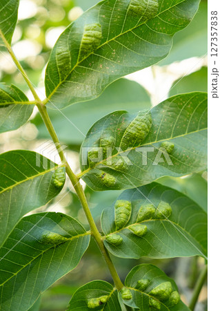 Walnut Leaves with Yellow Oval Galls Caused by Gall Mites Walnut Leaves with Yellow Oval Galls Caused by Gall Mites 127357838
