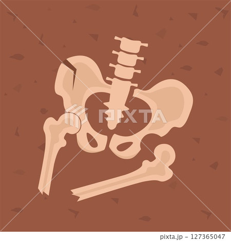 Pelvis human bones. Archaeological find. Historical value. Image for books, articles, posters, archeology, history of past, excavations presentations. Vector Pelvis human bones. Archaeological find. Historical value. Image for books, articles, posters, archeology, history of past, excavations presentations. Vector 127365047