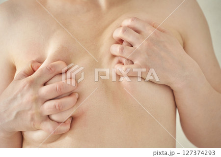 Close-up of caucasian male with skin folds and bare chest, highlighting personal 127374293