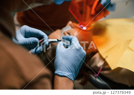 Using tools to install the aligner. Woman in the stomatology clinic, visiting dentist Using tools to install the aligner. Woman in the stomatology clinic, visiting dentist 127378349