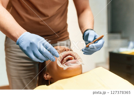 Lying on a chair. Installation of aligner. Woman in the stomatology clinic, visiting dentist Lying on a chair. Installation of aligner. Woman in the stomatology clinic, visiting dentist 127378365