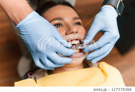 Lying on a chair. Installation of aligner. Woman in the stomatology clinic, visiting dentist 127378366