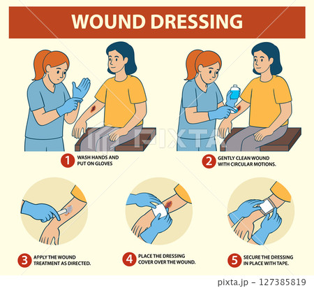 Step-by-Step Wound Dressing Guide Illustration Step-by-Step Wound Dressing Guide Illustration 127385819