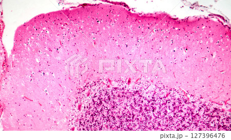 Human motor cortex, photomicrograph showing pyramidal neurons in cortical layers responsible for voluntary movement control and motor coordination. 127396476