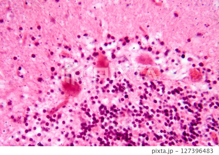 Human motor cortex, photomicrograph showing pyramidal neurons in cortical layers responsible for voluntary movement control and motor coordination. 127396483