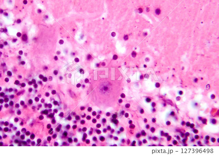 Human cerebellar cortex, photomicrograph showing Purkinje cells, granular cells, and molecular layer involved in motor coordination and balance. 127396498