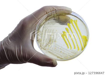 Colonies of different bacteria and mold fungi grown on Petri dish with nutrient agar 127396647