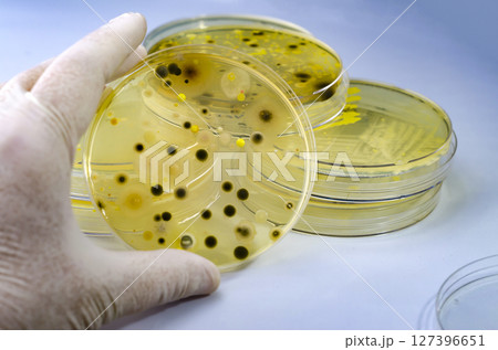 Colonies of different bacteria and mold fungi grown on Petri dish with nutrient agar Colonies of different bacteria and mold fungi grown on Petri dish with nutrient agar 127396651
