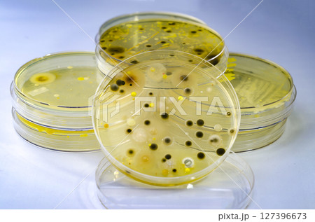 Colonies of different bacteria and mold fungi grown on Petri dish with nutrient agar Colonies of different bacteria and mold fungi grown on Petri dish with nutrient agar 127396673
