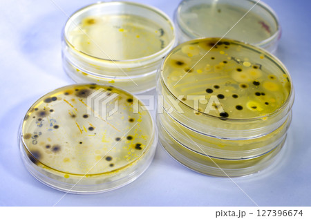 Colonies of different bacteria and mold fungi grown on Petri dish with nutrient agar Colonies of different bacteria and mold fungi grown on Petri dish with nutrient agar 127396674