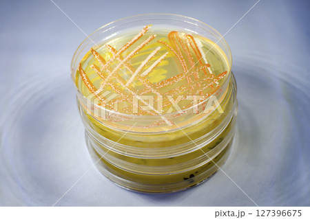 Colonies of different bacteria and molds Colonies of different bacteria and molds 127396675