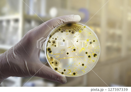 Colonies of different bacteria and mold fungi grown on Petri dish with nutrient agar Colonies of different bacteria and mold fungi grown on Petri dish with nutrient agar 127397339