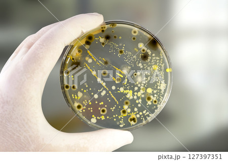 Colonies of different bacteria and mold fungi grown on Petri dish with nutrient agar Colonies of different bacteria and mold fungi grown on Petri dish with nutrient agar 127397351