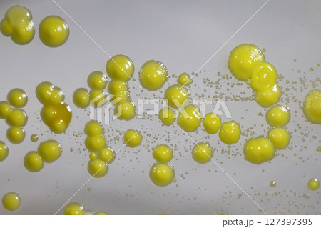 Bacteria grown from skin smear Bacteria grown from skin smear 127397395