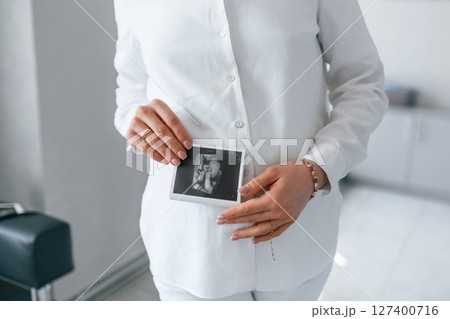 Woman in white coat is holding ultrasound picture of baby photo Woman in white coat is holding ultrasound picture of baby photo 127400716