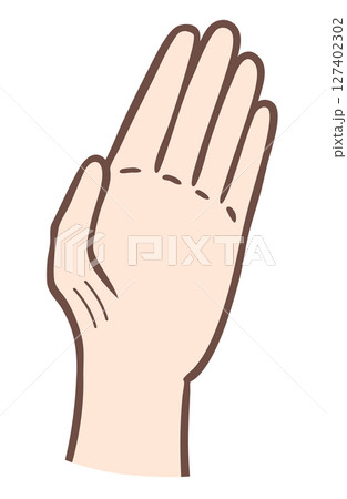 正中神経麻痺による猿手 正中神経麻痺による猿手 127402302