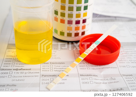 Urinalysis, urine cup with reagent strip pH paper test and comparison chart in laboratory. 127406592