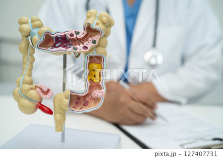 Intestine, appendix and digestive system, doctor holding anatomy model for study diagnosis and treatment in hospital. Intestine, appendix and digestive system, doctor holding anatomy model for study diagnosis and treatment in hospital. 127407731