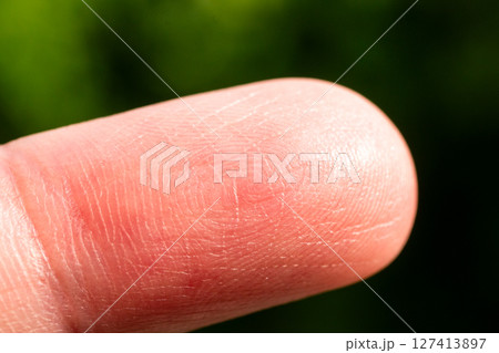 Close-up finger tip macro in nature green background textured skin detail 127413897