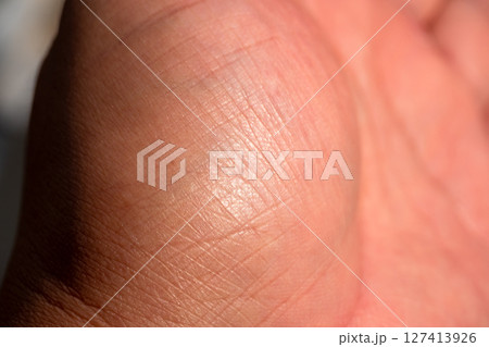 Examining skin texture human palm macro indoor lighting close-up dermatology insights 127413926