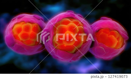Understanding the Different Stages of Cancer Through Detailed Cellular Imagery and Analysis Understanding the Different Stages of Cancer Through Detailed Cellular Imagery and Analysis 127419073