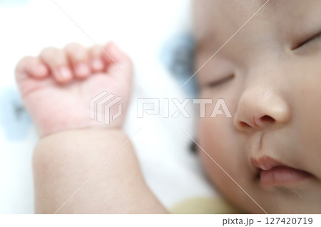 鼻に自分の爪でつけた引っ掻き傷がある赤ちゃん 127420719