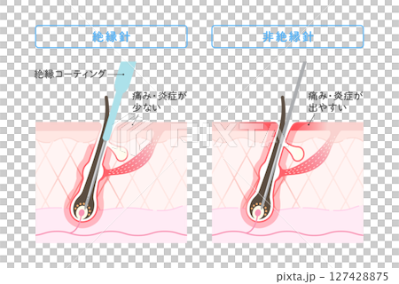 ニードル脱毛 絶縁針と非絶縁針の違い 127428875