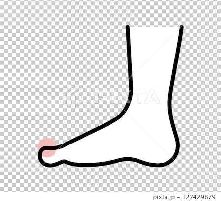 足の爪が痛むアイコンイラスト　ベクター 127429879
