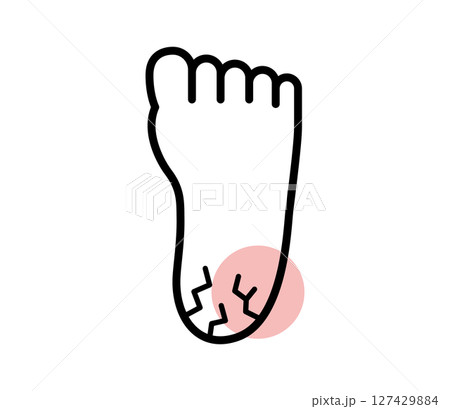 かかとがひび割れているアイコンイラスト　べくたー 127429884