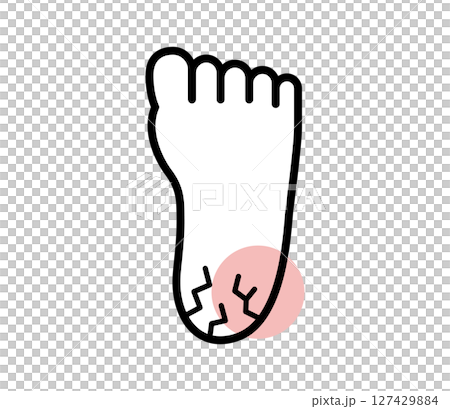 かかとがひび割れているアイコンイラスト　べくたー 127429884