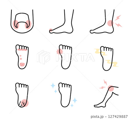 シンプルな足の症状のイラストセット　ベクター 127429887