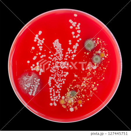 Bacterial and mold fungi colonies grown from indoor air on blood sheep agar 127445751