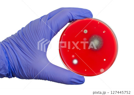 Bacterial and mold fungi colonies grown from indoor air on blood sheep agar Bacterial and mold fungi colonies grown from indoor air on blood sheep agar 127445752