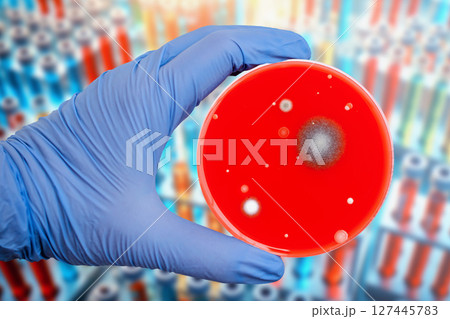 Bacterial and mold fungi colonies grown from indoor air on blood sheep agar Bacterial and mold fungi colonies grown from indoor air on blood sheep agar 127445783