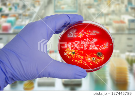 Bacterial and mold fungi colonies grown from indoor air on blood sheep agar Bacterial and mold fungi colonies grown from indoor air on blood sheep agar 127445789