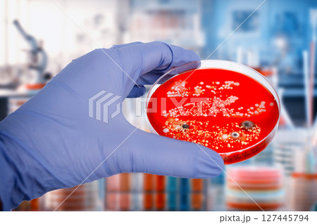 Bacterial and mold fungi colonies grown from indoor air on blood sheep agar Bacterial and mold fungi colonies grown from indoor air on blood sheep agar 127445794