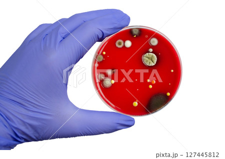 Bacterial and mold fungi colonies grown from indoor air on blood sheep agar Bacterial and mold fungi colonies grown from indoor air on blood sheep agar 127445812
