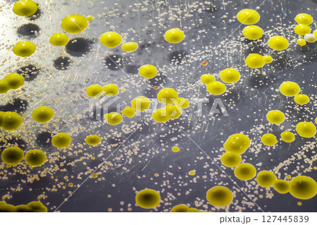 Bacteria grown from skin smear, colonies of Micrococcus luteus and Staphylococcus epidermidis 127445839