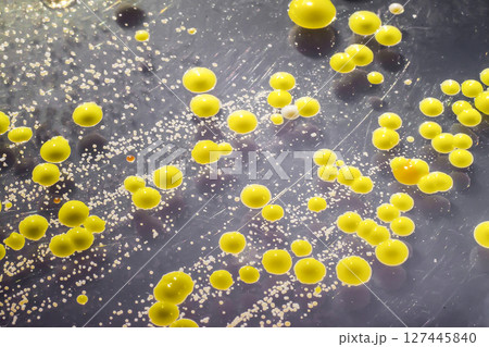 Bacteria grown from skin smear, colonies of Micrococcus luteus and Staphylococcus epidermidis 127445840