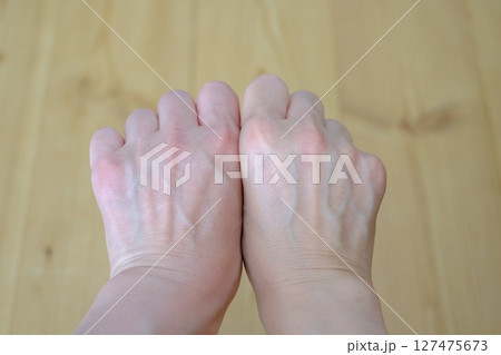 40代女性の血管 127475673