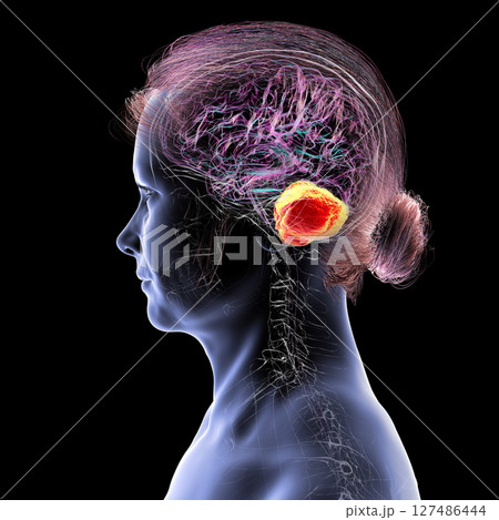Human brain with highlighted cerebellum, 3D illustration. Cerebellum is responsible for coordination, balance, and fine motor control. Damaged in ataxia and neurodegenerative disorders 127486444